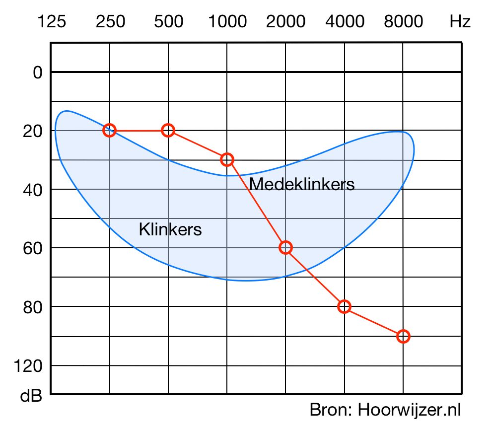 Om spraak te kunnen horen is het belangrijk dat je de klinkers en medeklinkers kan horen. 