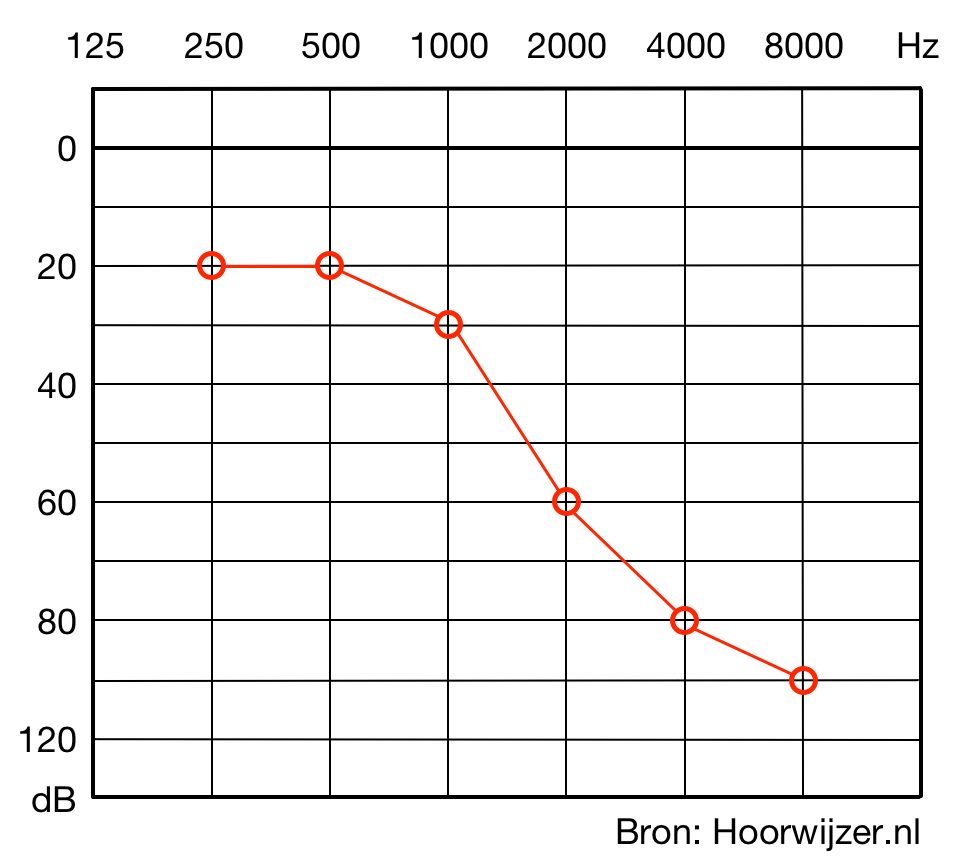 In het toonaudiogram kan je per frequentie zien hoe hard het geluid moet zijn in decibellen wil jij het kunnen horen.